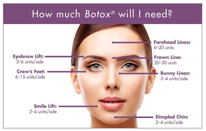 Hướng dẫn sử dụng Botox Mỹ allergan