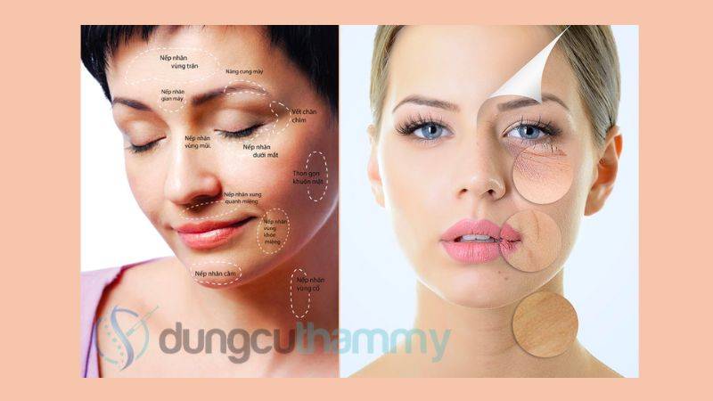 Cơ chế hoạt động của tiêm botox xóa nhăn