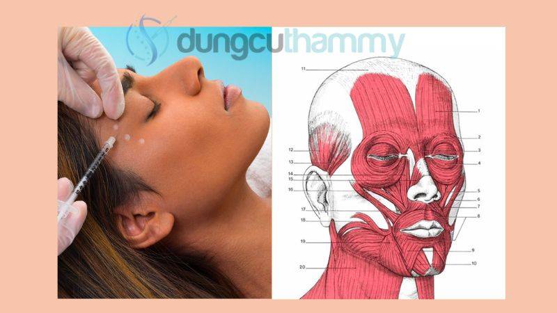 Đánh dấu và gây tê