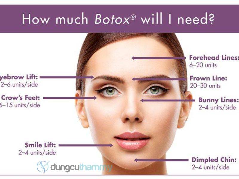 Botox Mỹ giá bao nhiêu